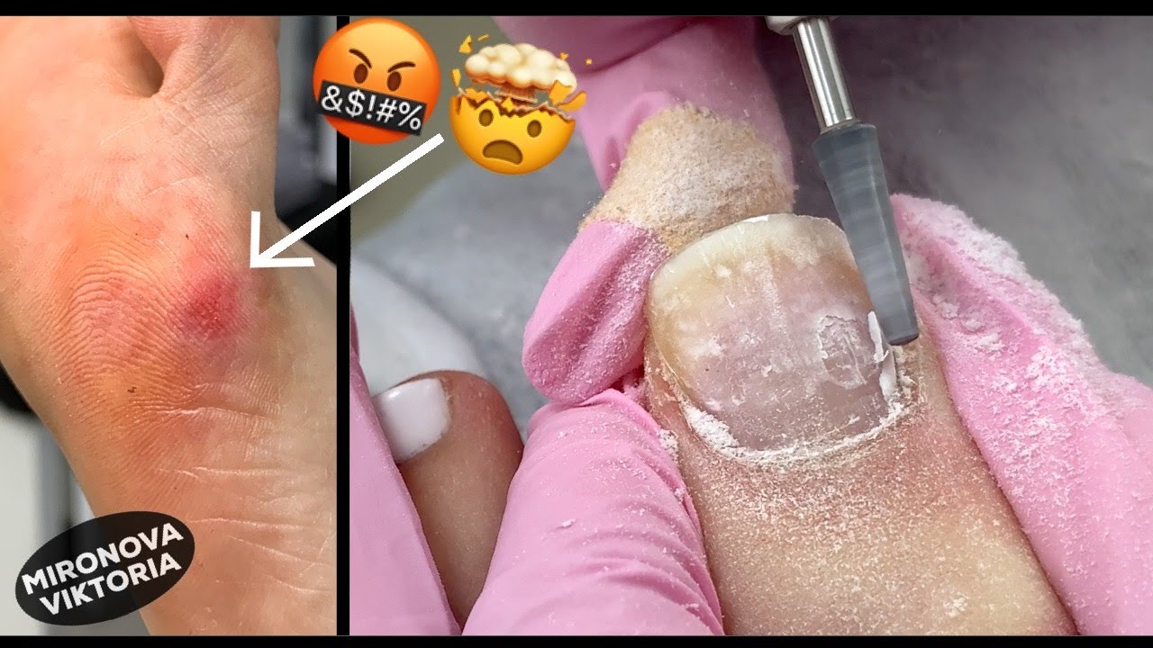 Мой ужасный педикюр😢/ Так делать нельзя!!!