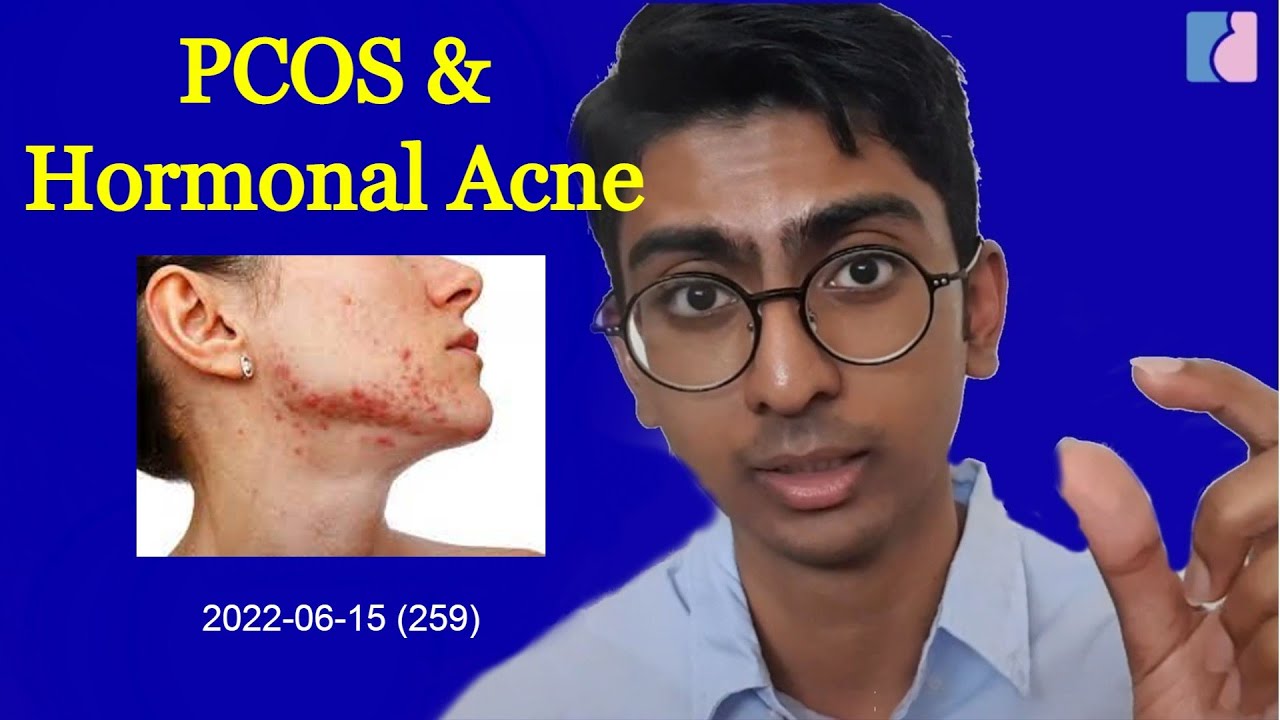 PCOS & Hormonal Acne: The real cause behind your acne - Antai Hospitals