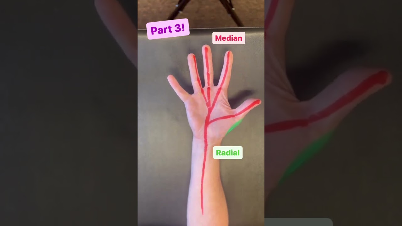 A Trapped Ulnar Nerve Creates Pinky and Ring Finger Symptoms