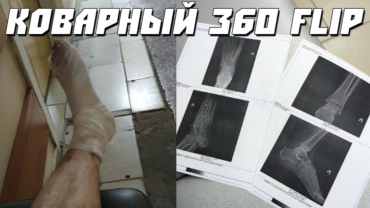Иногда не все идет по плану. 360 flip. ТРЮК ЗА МЕСЯЦ#3