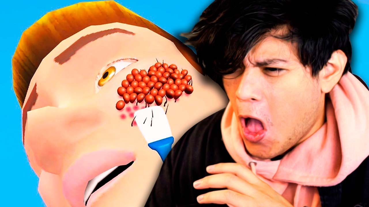 El SIMULADOR de quitar GRANOS!!!! 🤢🤢(juegos de anuncios)