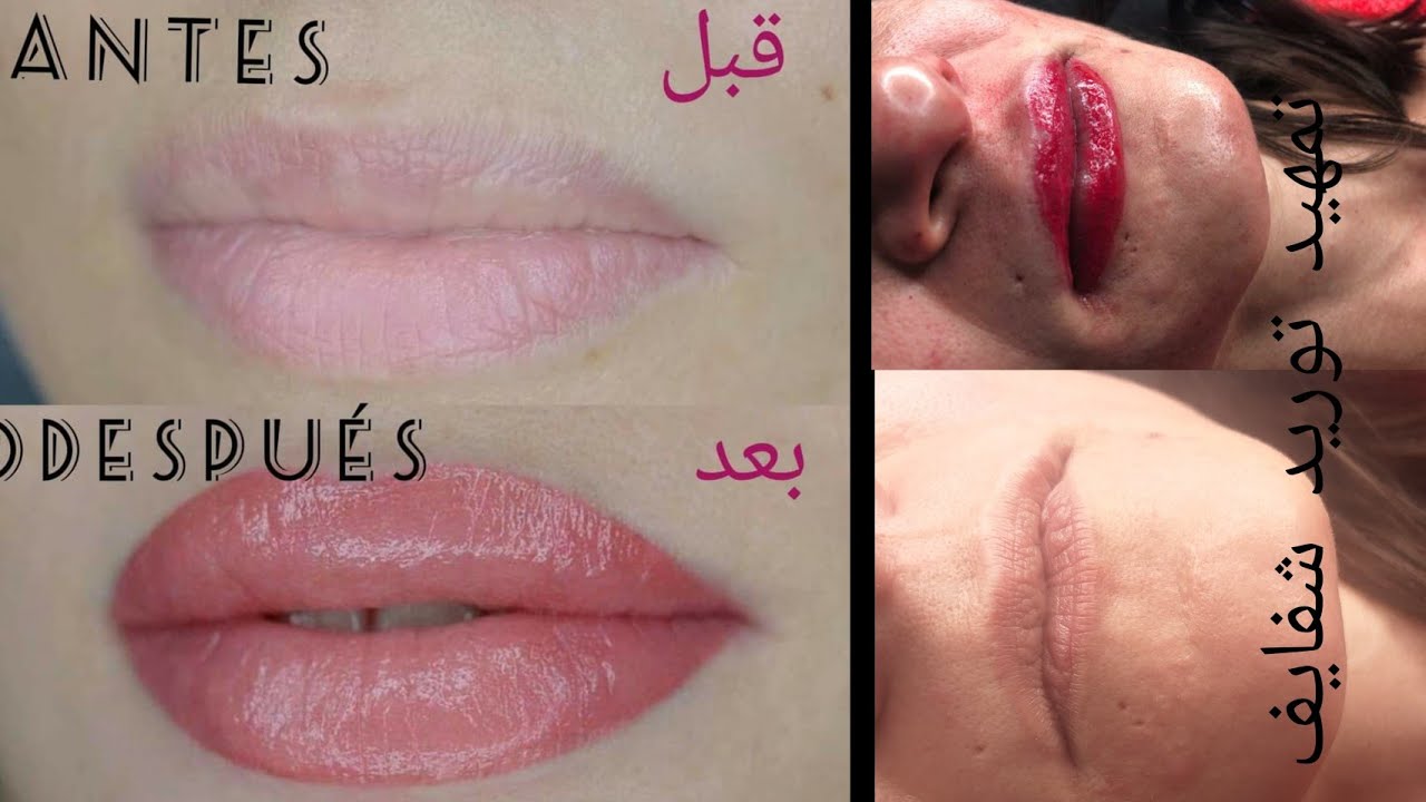 توريد شفايف فيديو تمهيدي
