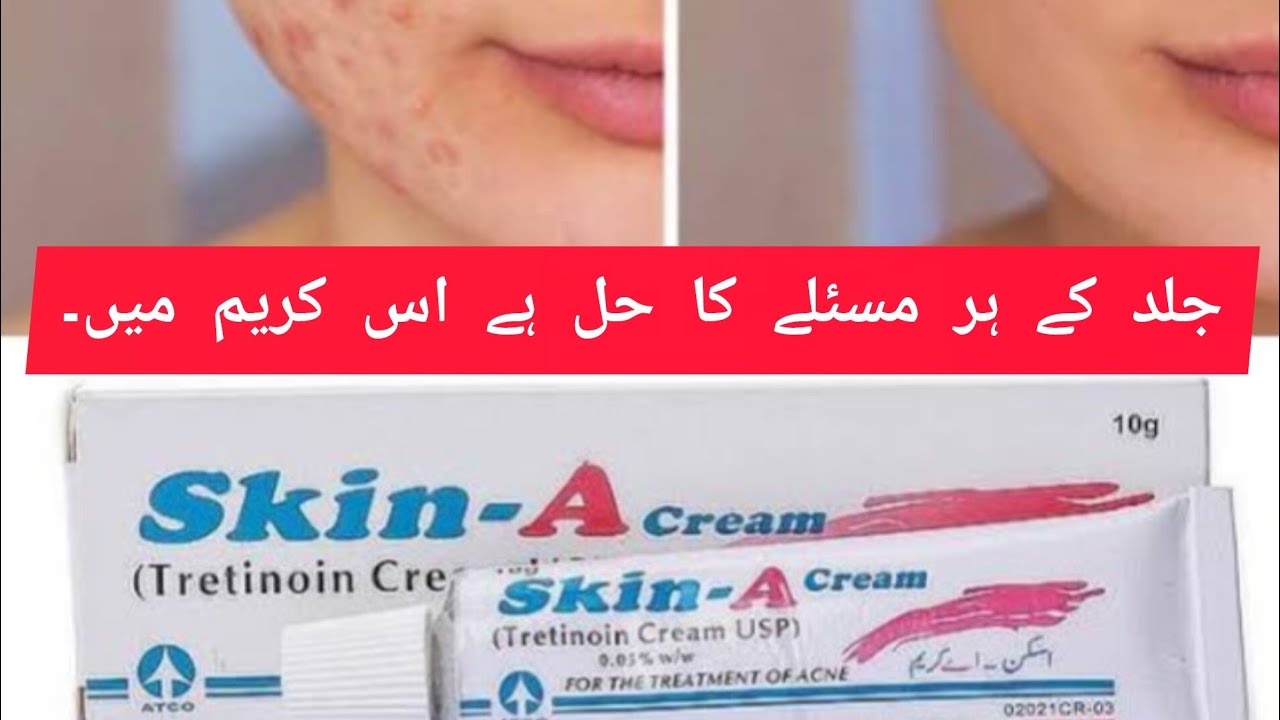Skin-A Cream Review | Skin-A Cream Uses and side effect | Must Watch Before using #Skinacream