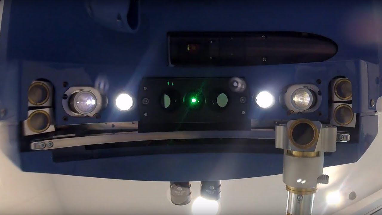 Lézeres szemműtét a Páciens szemével [GoPro] Augenlasern