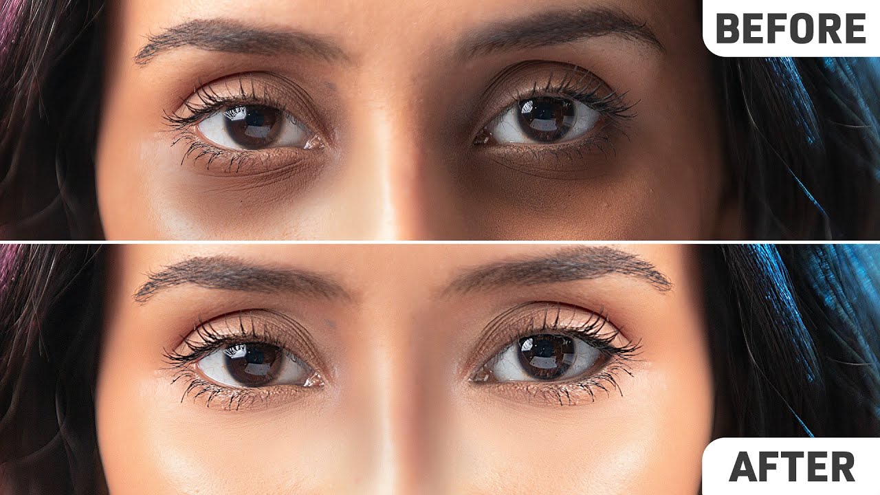 Remove Dark Circles Permanently FAST! | Natural Home Remedies