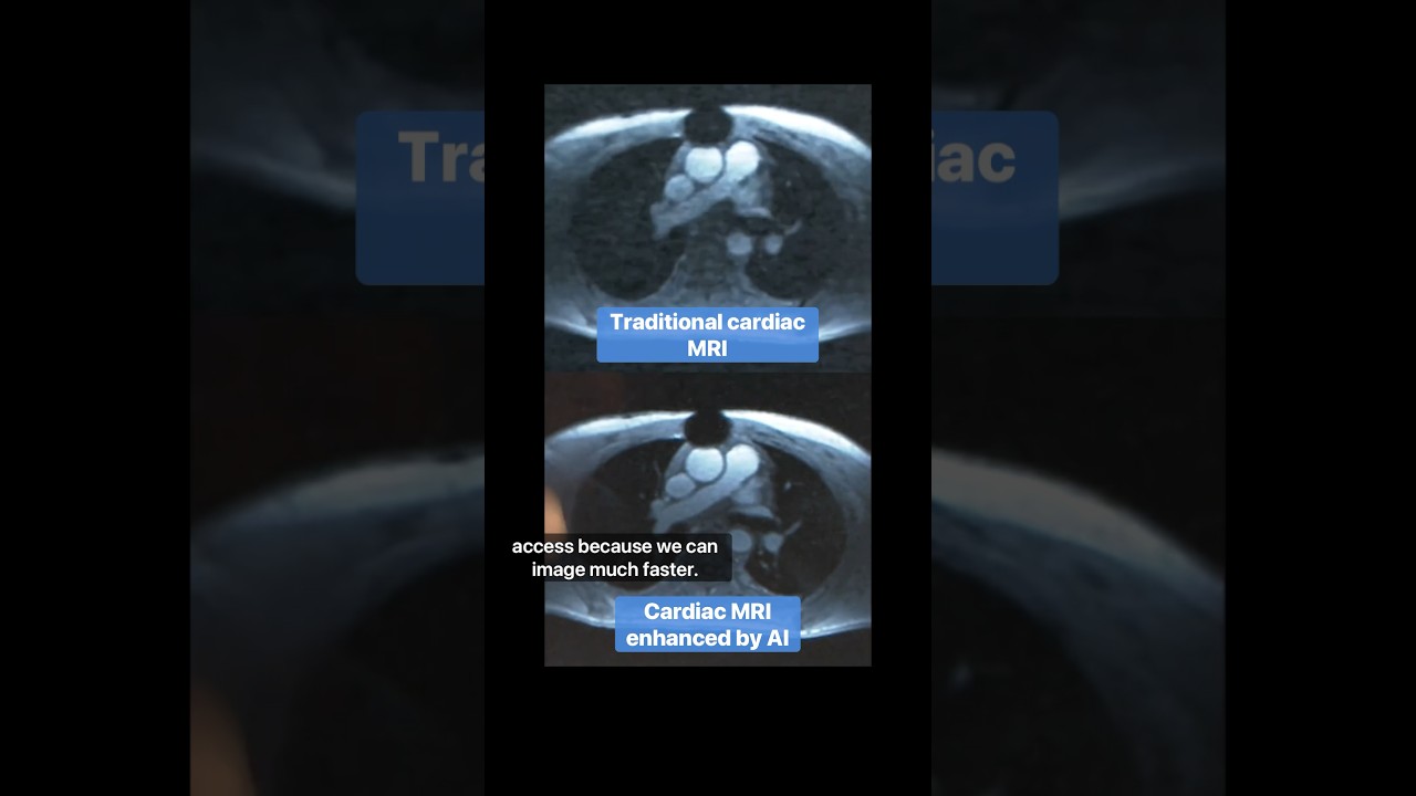 How AI is Changing Medical Imaging