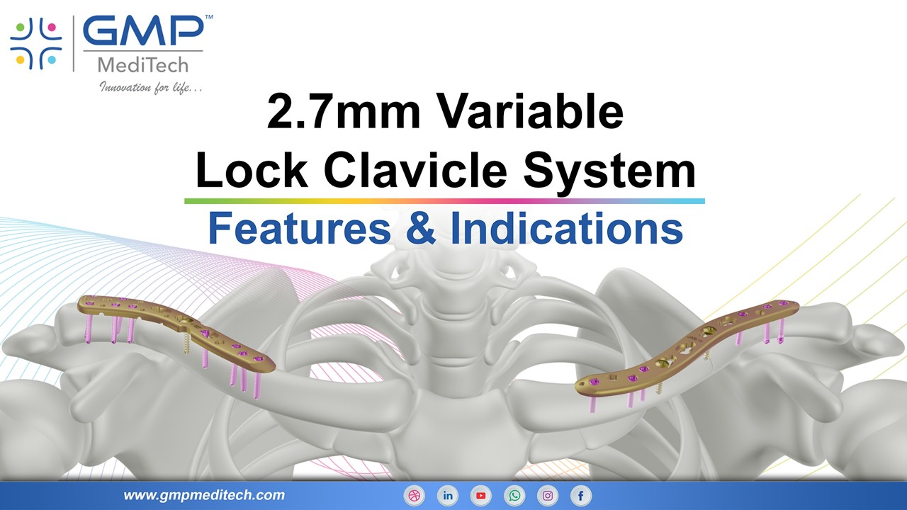Variable Angle Clavicle Locking System | Advanced Fixation for Clavicle Fractures
