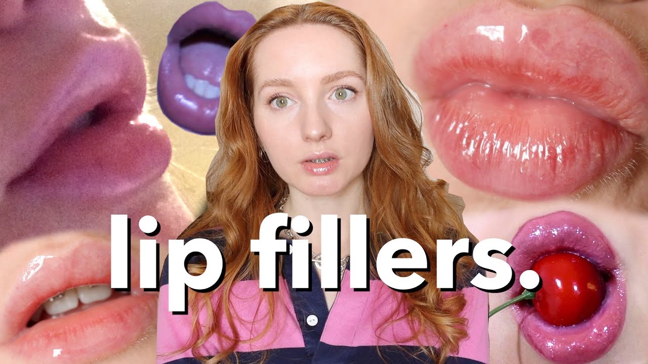 Let's talk about Lip Fillers. (+ my experience)