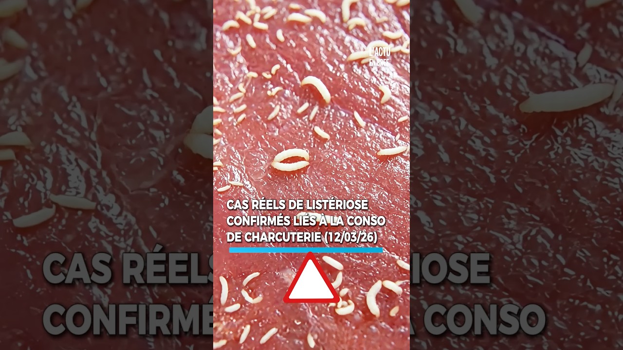 Charcuterie rappel&eacute;e ! Plusieurs cas de list&eacute;riose d&eacute;tect&eacute;s.