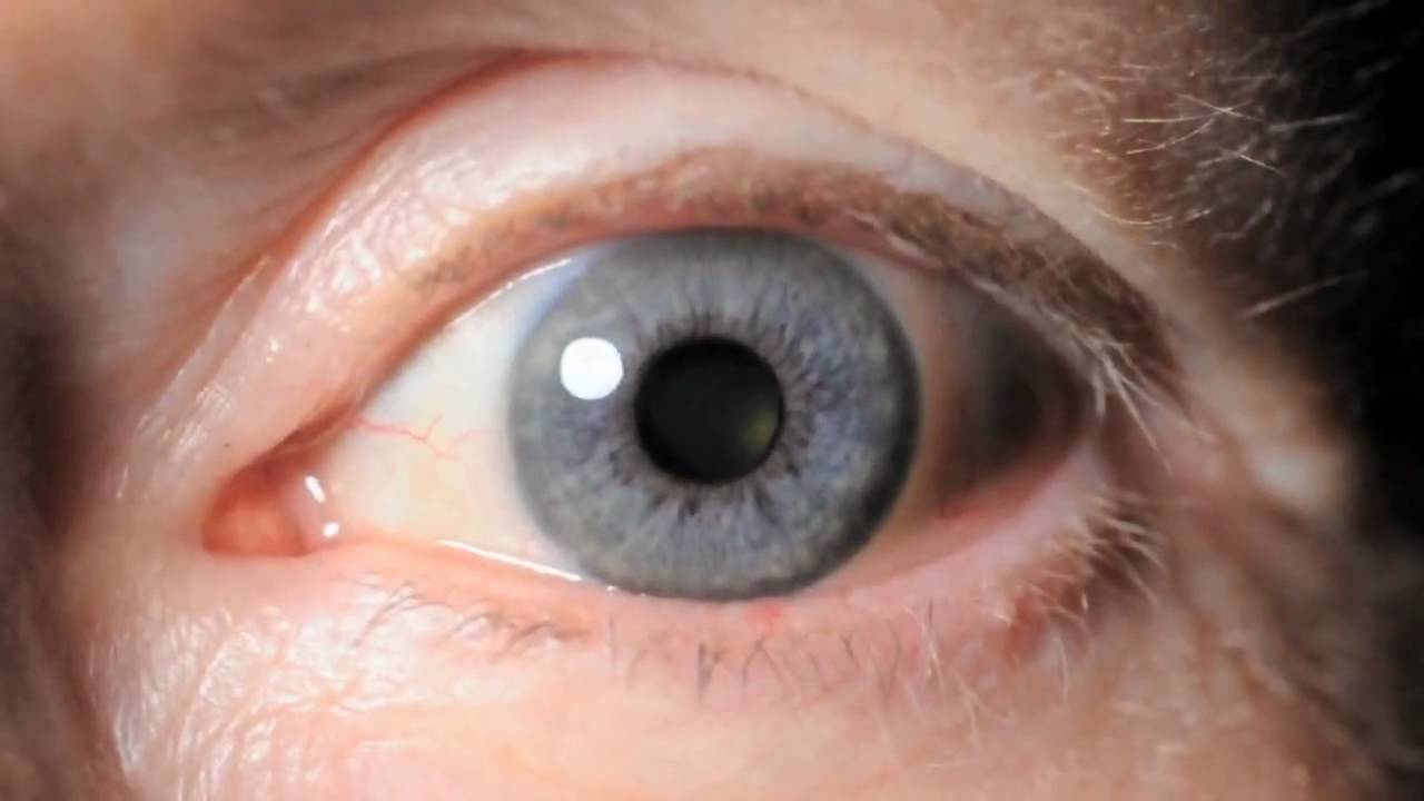 EYEBALL