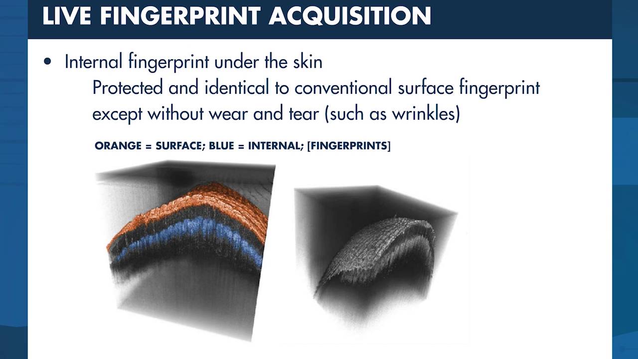 Optical coherence tomography