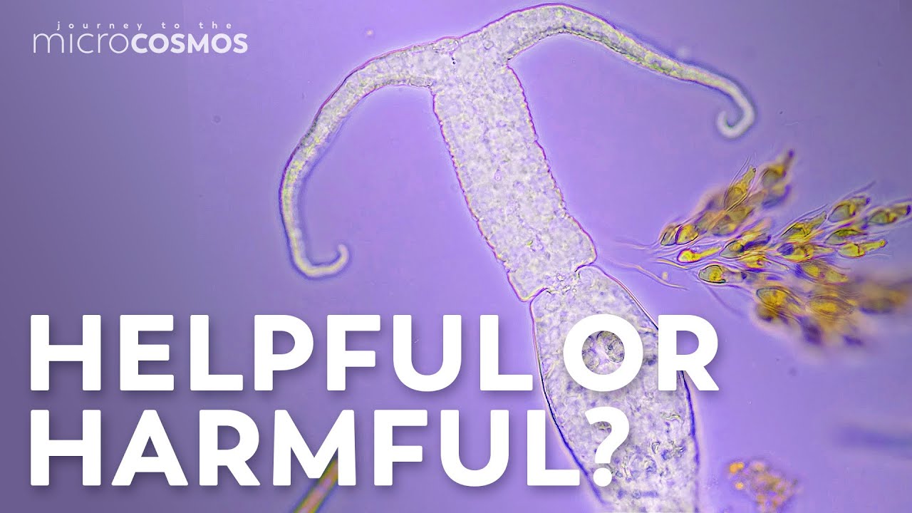 Are Microbes Good Or Bad For Humans?