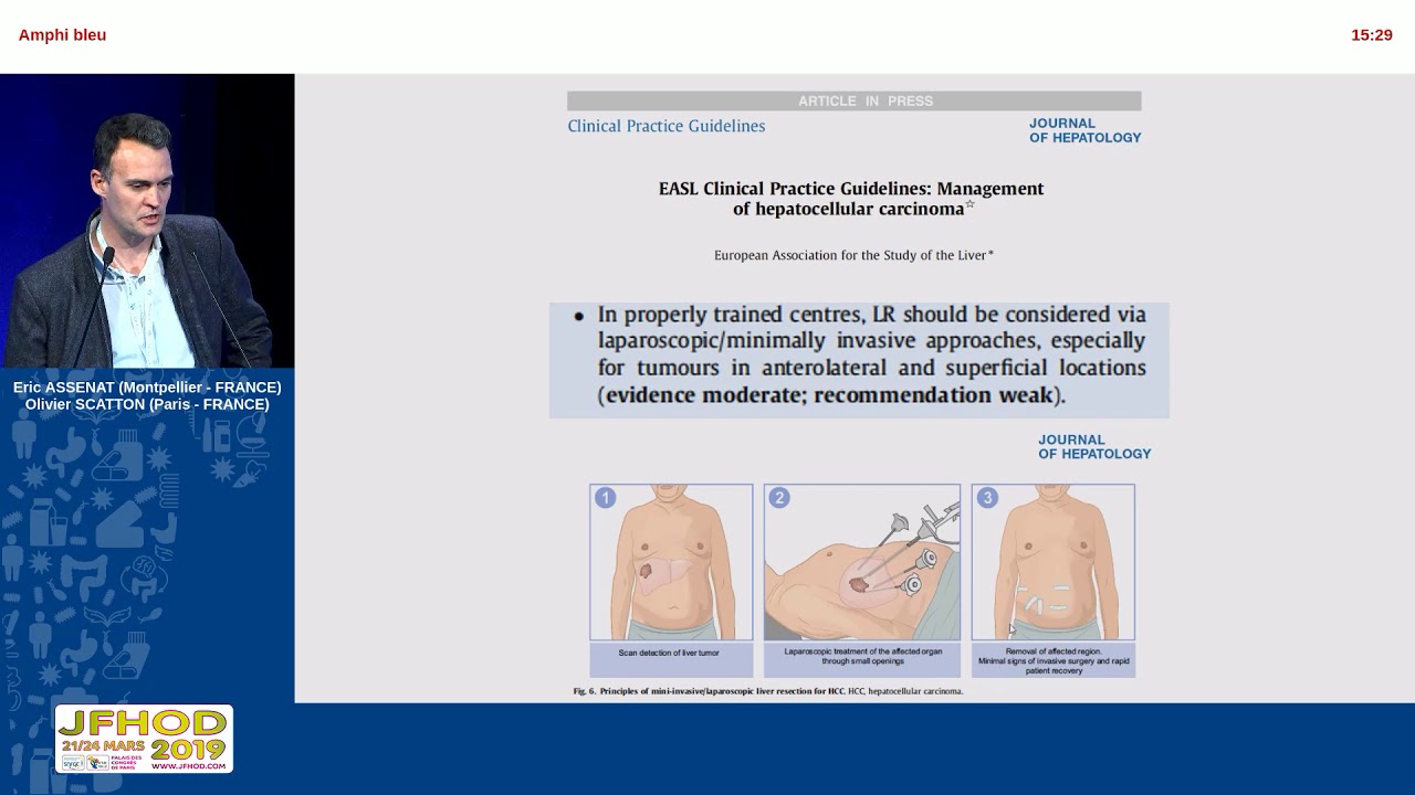 Les traitements curatifs du CHC - O. SCATTON, E. ASSENAT