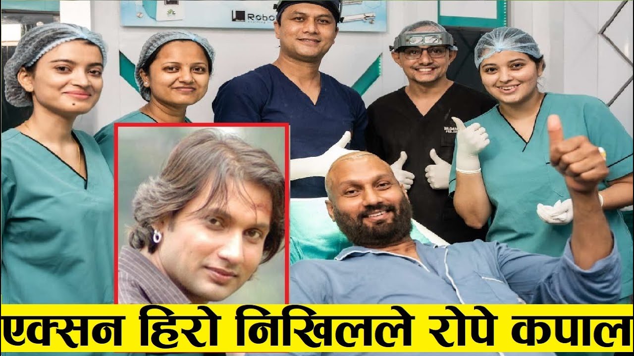 Nikhil Upreti ले कपाल रोपे, यसरी भयो आवारणमा हेरय ट्रान्सप्लन्ट? Nikhil Uprety Hair Transplant Video