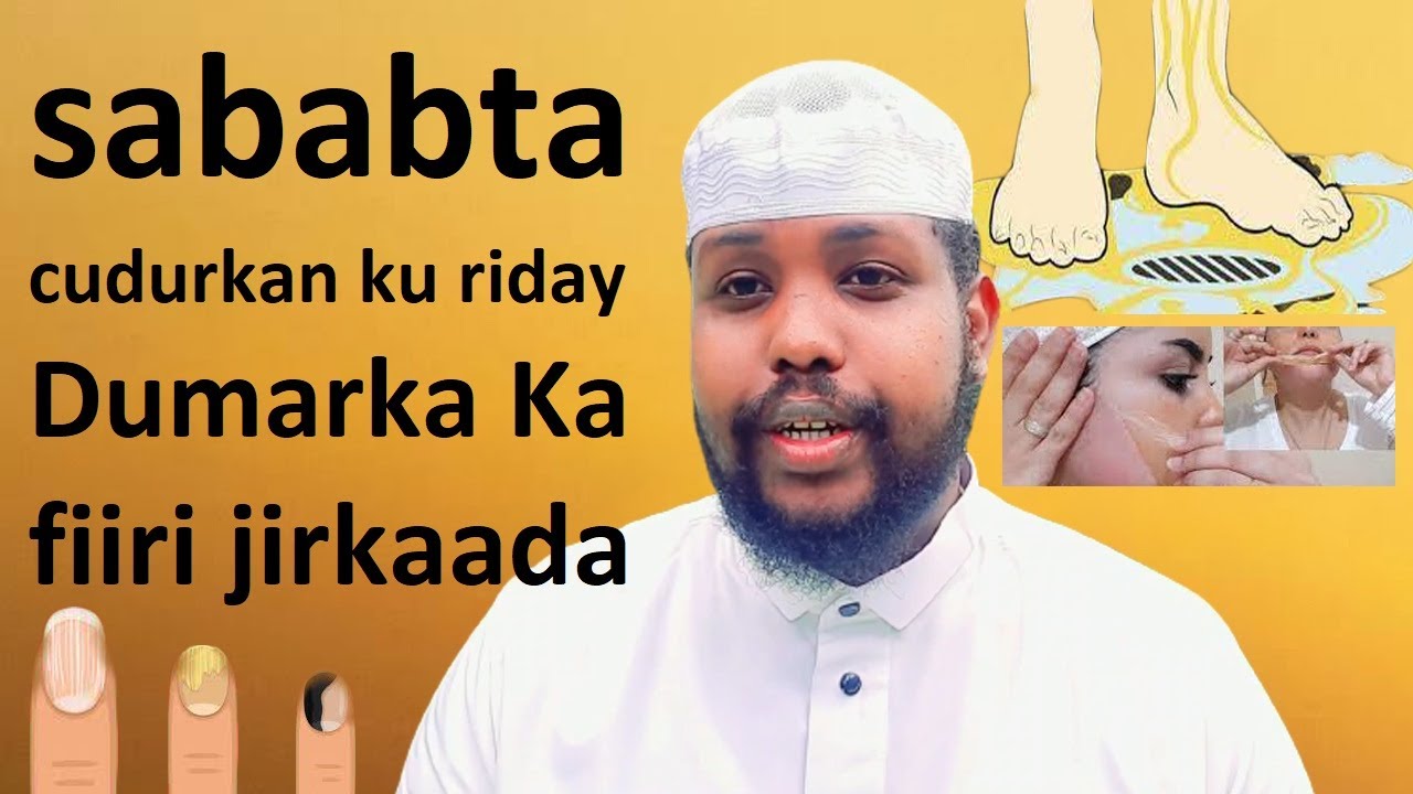 Cudur Dumarka ugooniya wan kaaga Digaya sababta keentay ogow jirkaada ka fiiri arimahan iskana Gaar