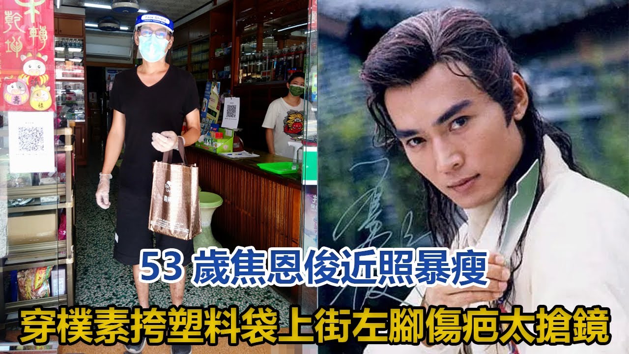 53歲焦恩俊近照暴瘦！穿着樸素挎塑料袋上街，左腳傷疤太搶鏡