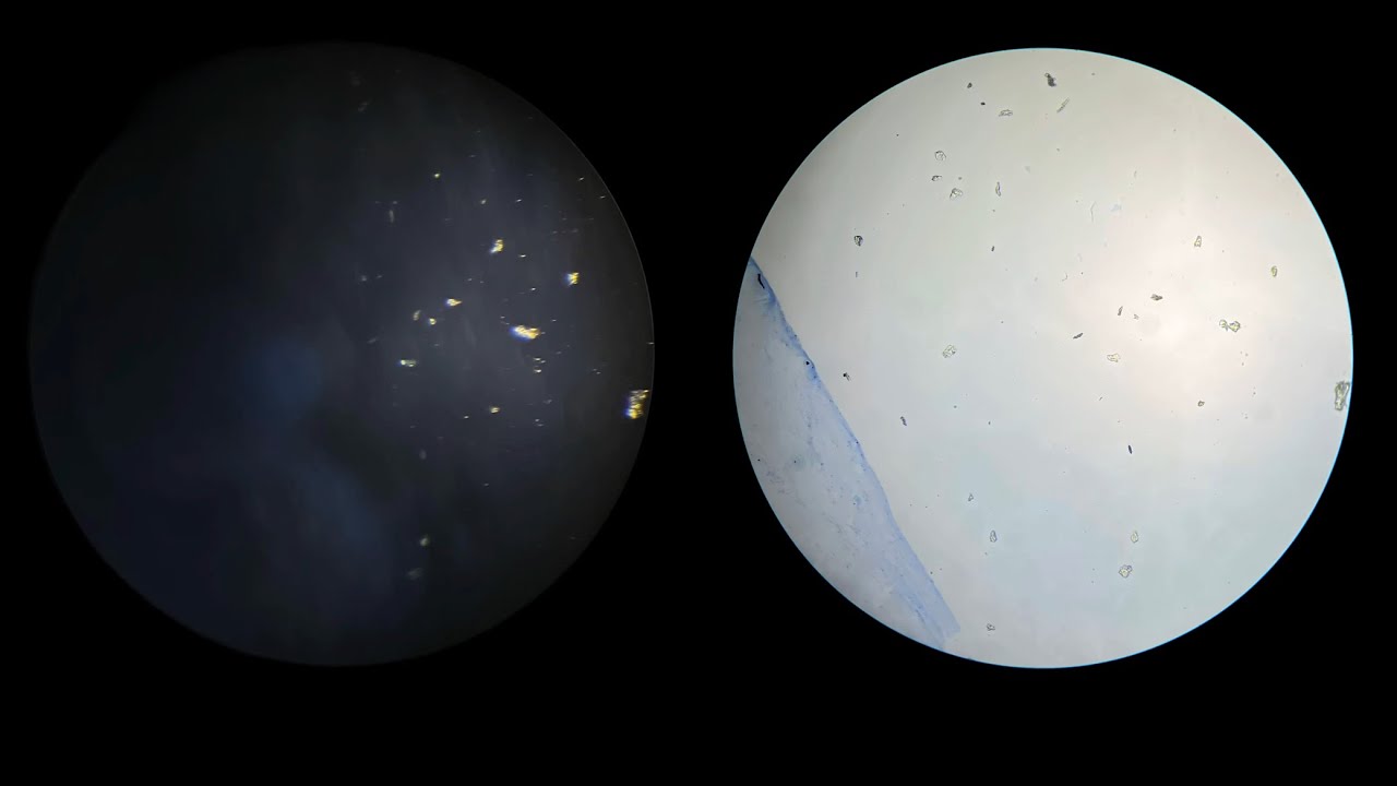 Cristales de Oxalato en microscopio 