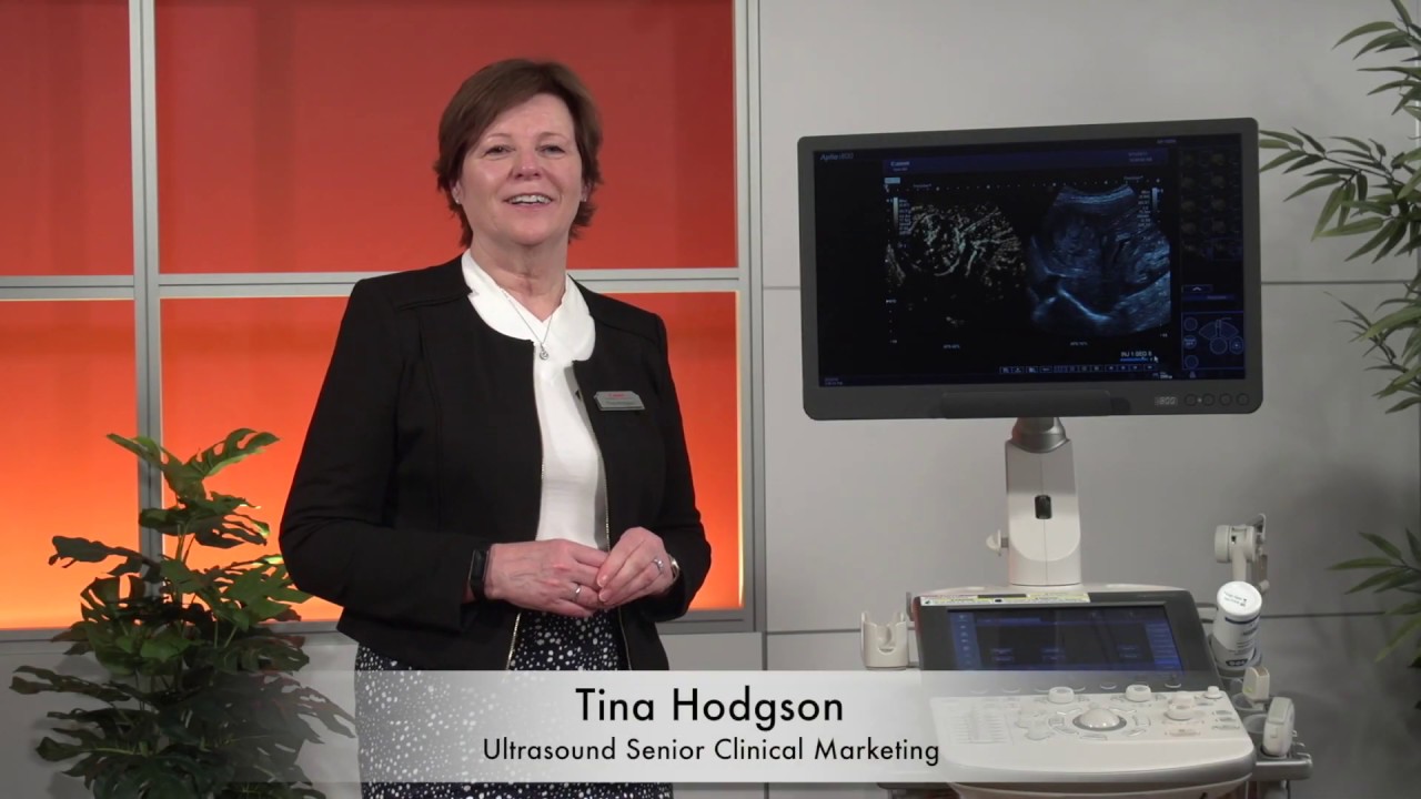 Parametric MicroFlow Imaging (MFI)