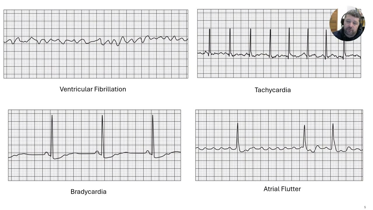 Lecture 13   Cardiovascular Part C