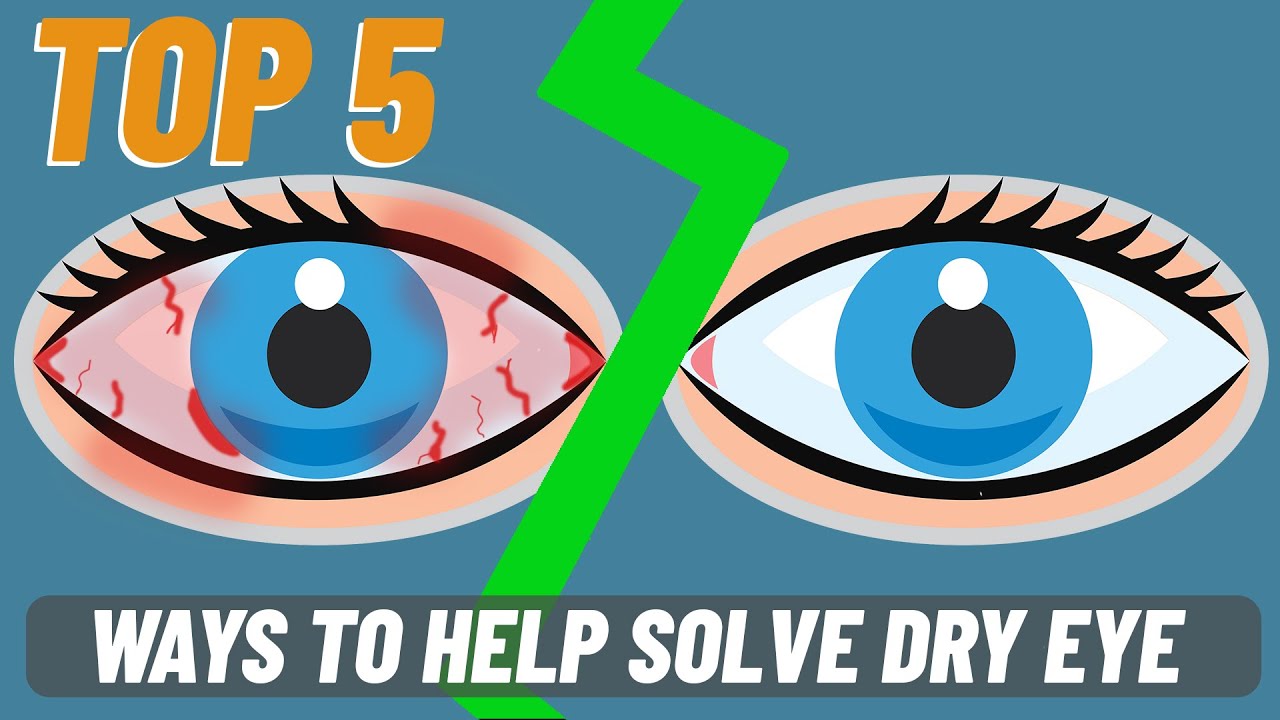 5 Effective Ways To Help Dry Eyes