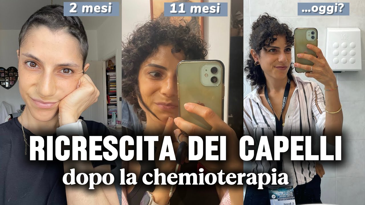 Ricrescita dei capelli dopo la CHEMIOTERAPIA: ecco cosa devi sapere.