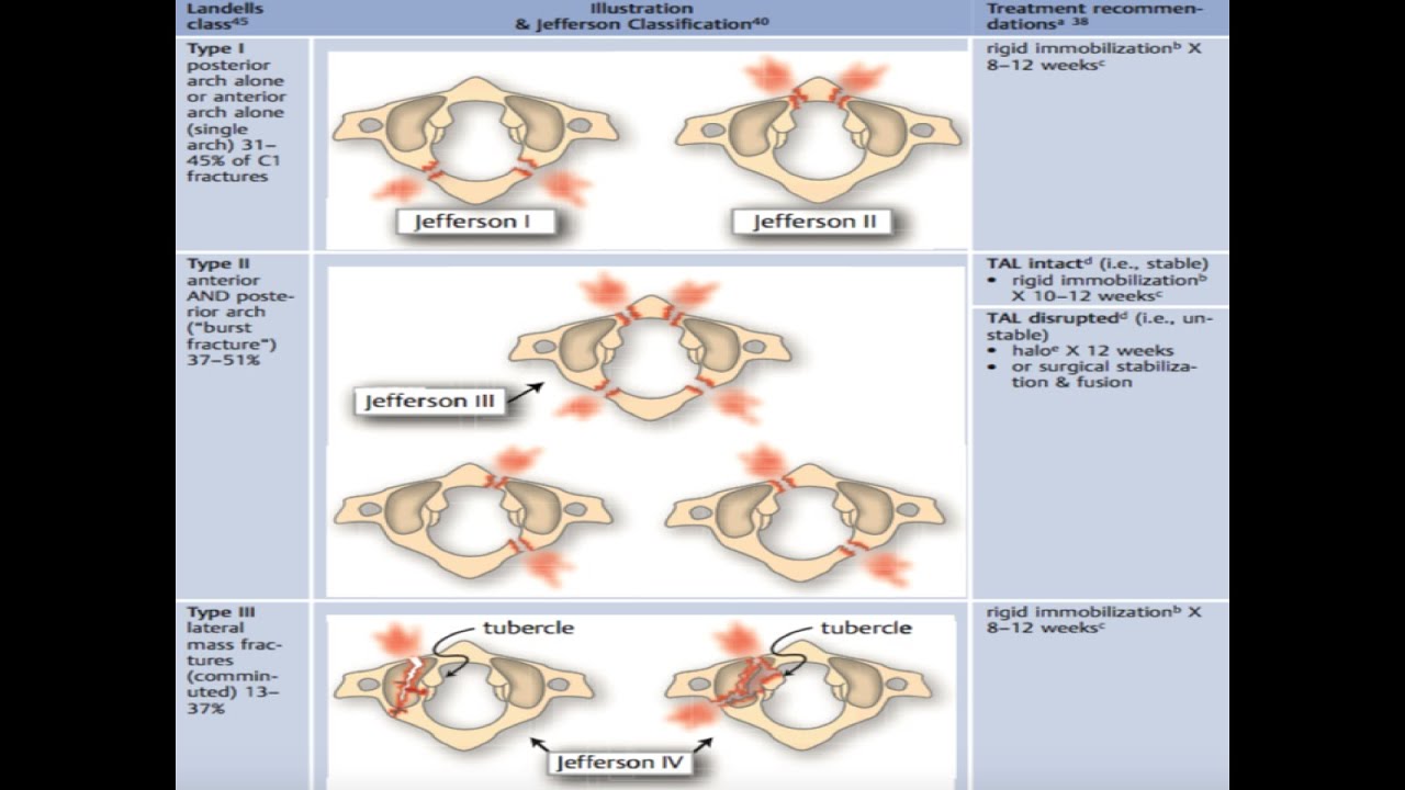 Spine Trauma (4):  Atlas (C1) fracture  إصابات الفقرات العنقية