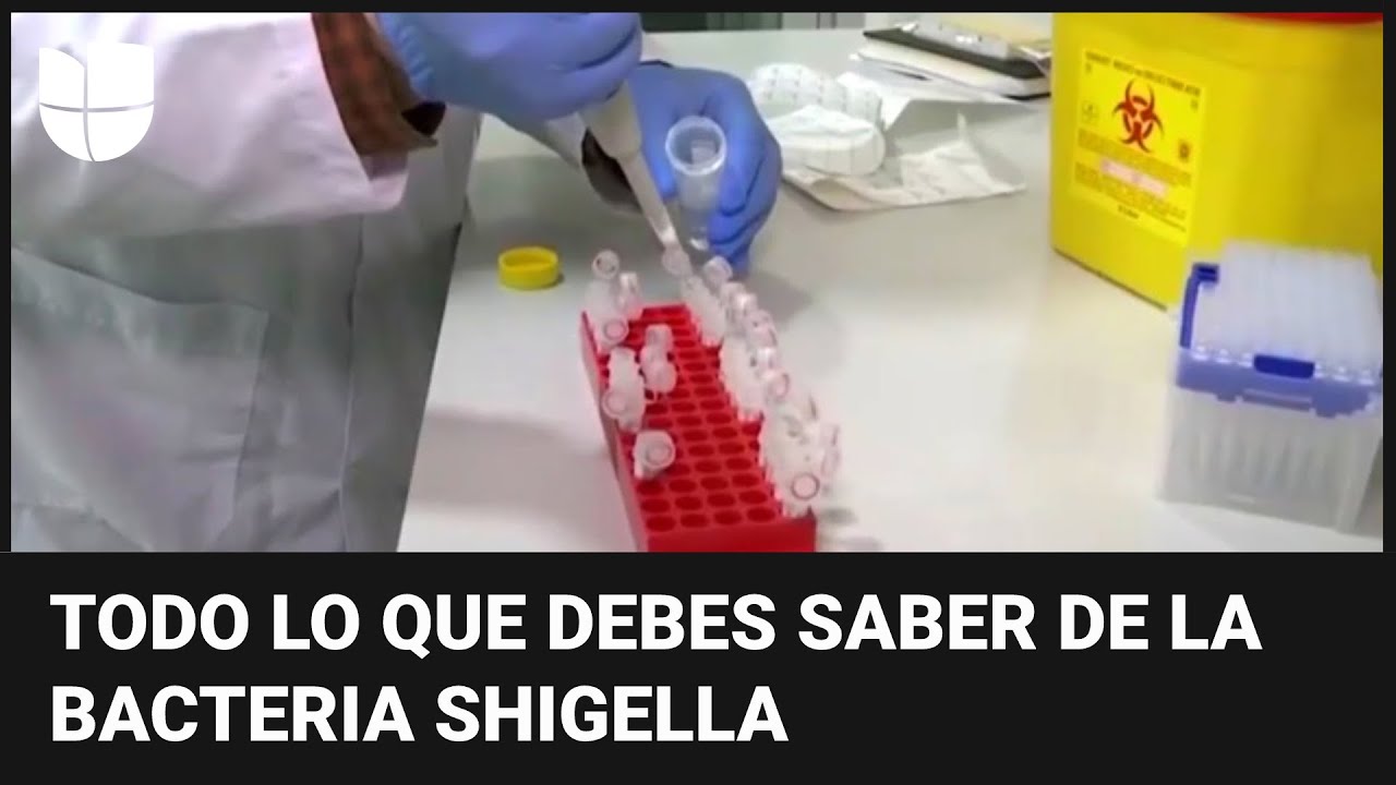 Bacteria Shigella en EEUU: a quiénes afecta, cómo se transmite y cuáles son sus síntomas