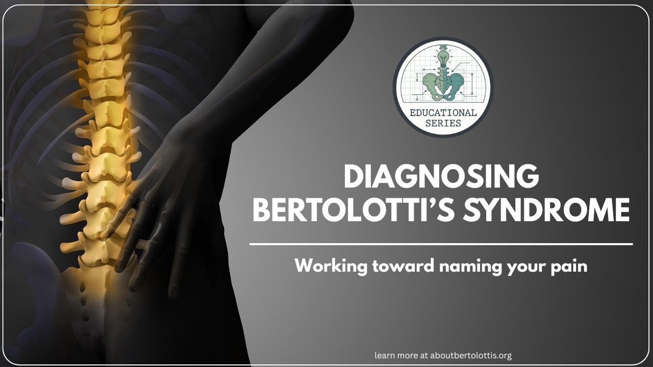 How is Bertolotti's Syndrome diagnosed?