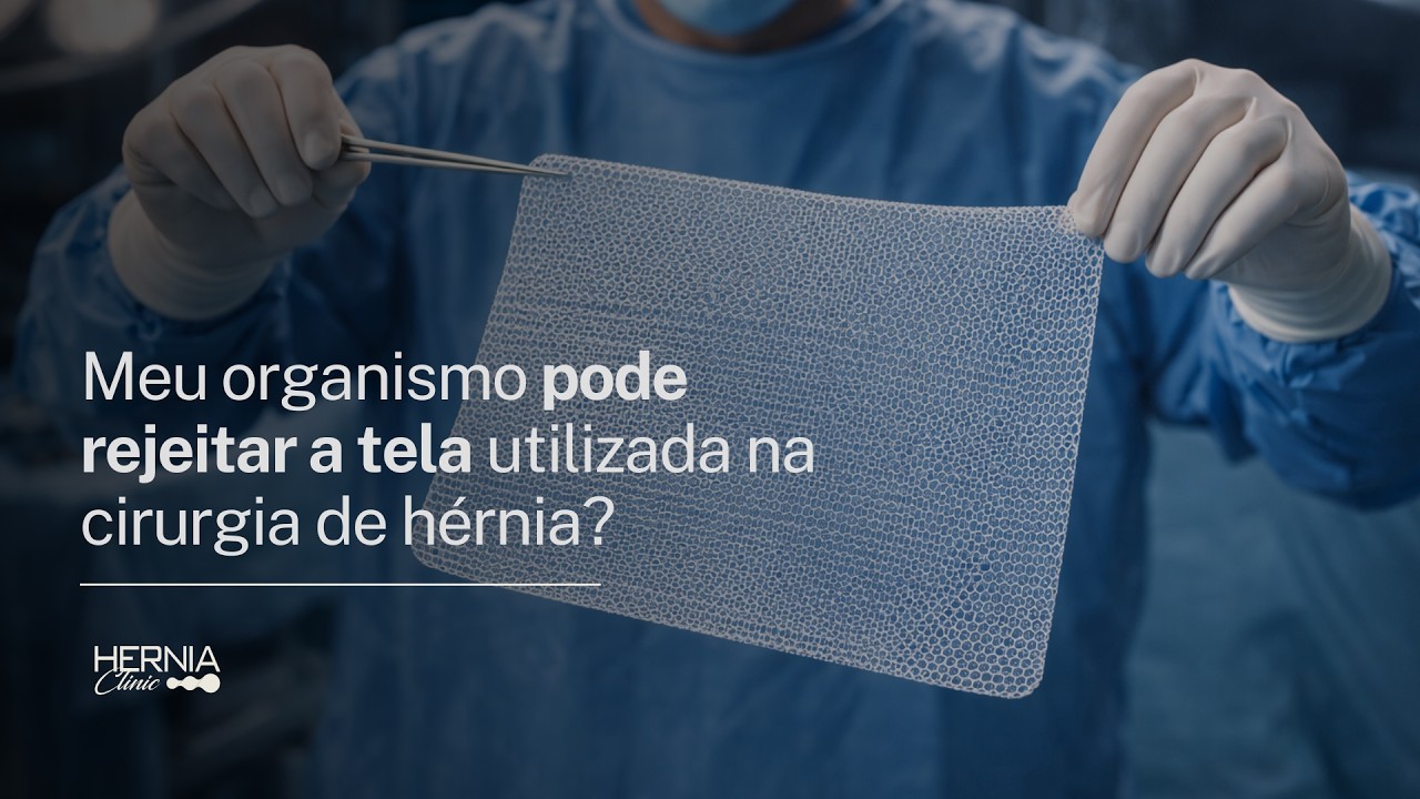 Meu organismo pode rejeitar a tela utilizada na cirurgia de hérnia? | Dr. Paulo Barros CRM 141104