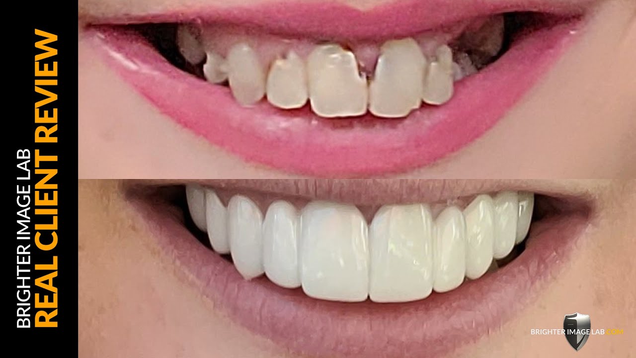Brighter Image Lab Real Client Review 