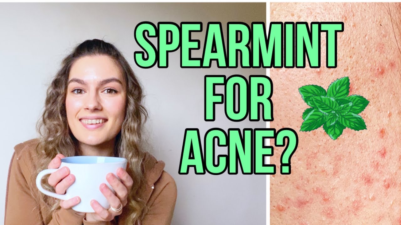 I Drank Spearmint Tea For 30 Days To Heal Hormonal Acne| Before and After