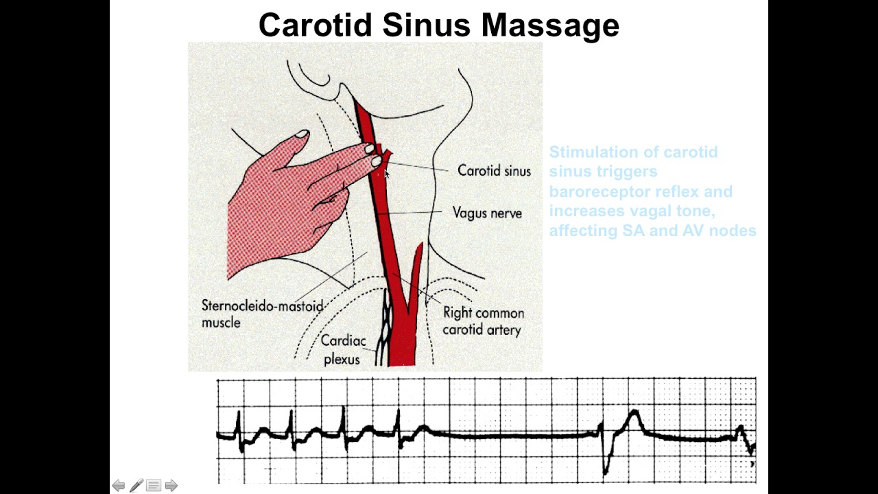 Treatment of Arrhythmias: Part 2
