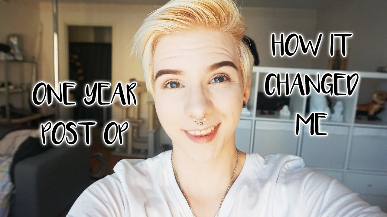 1 YEAR POST-OP (TOP SURGERY) AND HOW IT CHANGED ME | JACK PENDRAGON