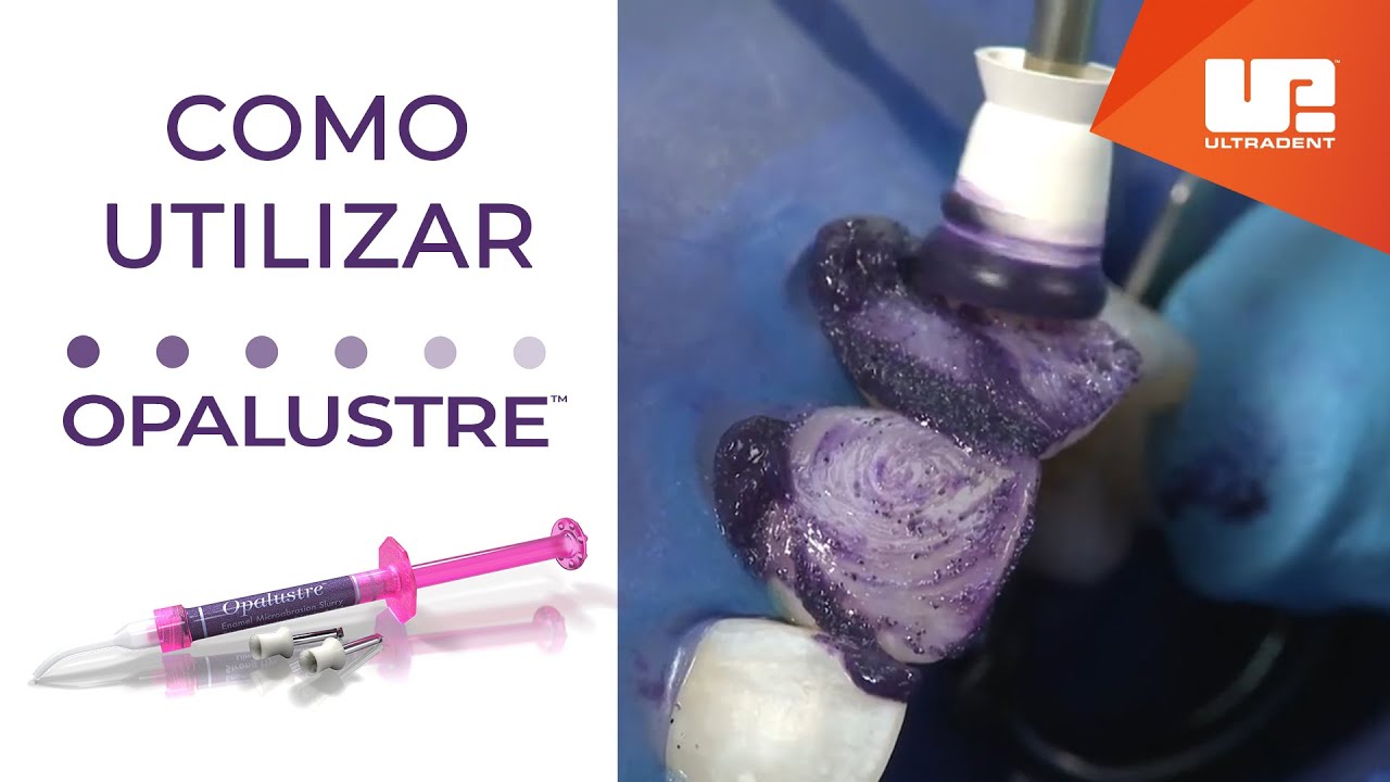 Como Utilizar Opalustre | Pasta de abrasión química y mecánica
