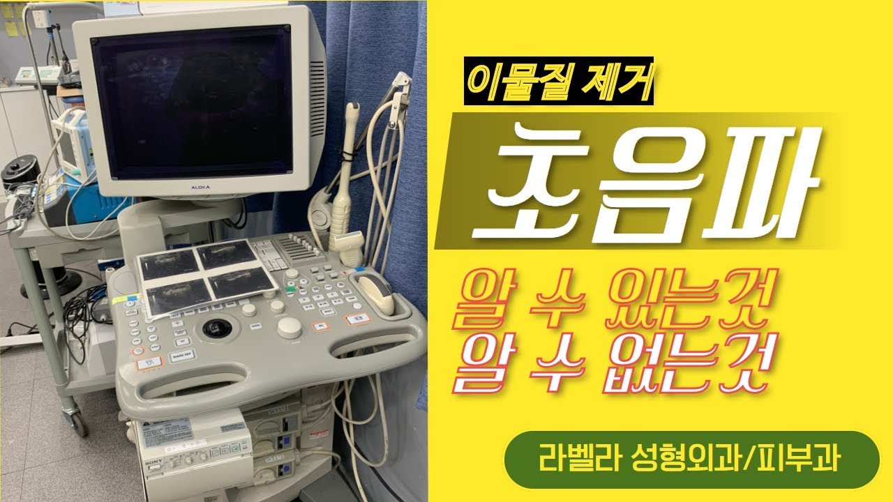 이물질 제거 초음파 검사로 알수 있는 것과 알 수 없는것?(필러 초음파)