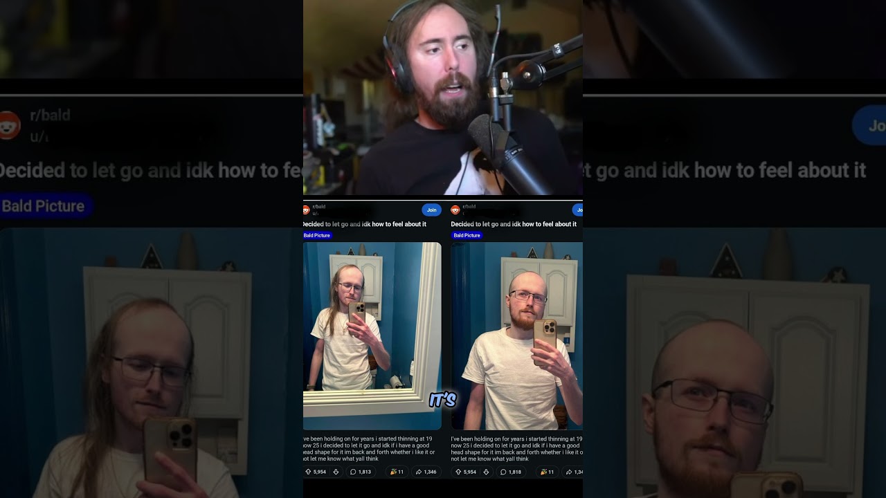 Asmongold will not shave his head