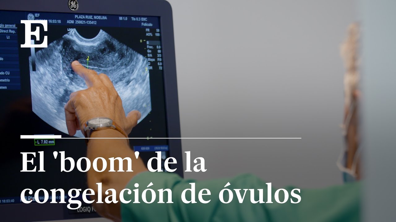 CONGELACIÓN DE ÓVULOS, cómo se lleva a cabo el proceso | REPORTAJE