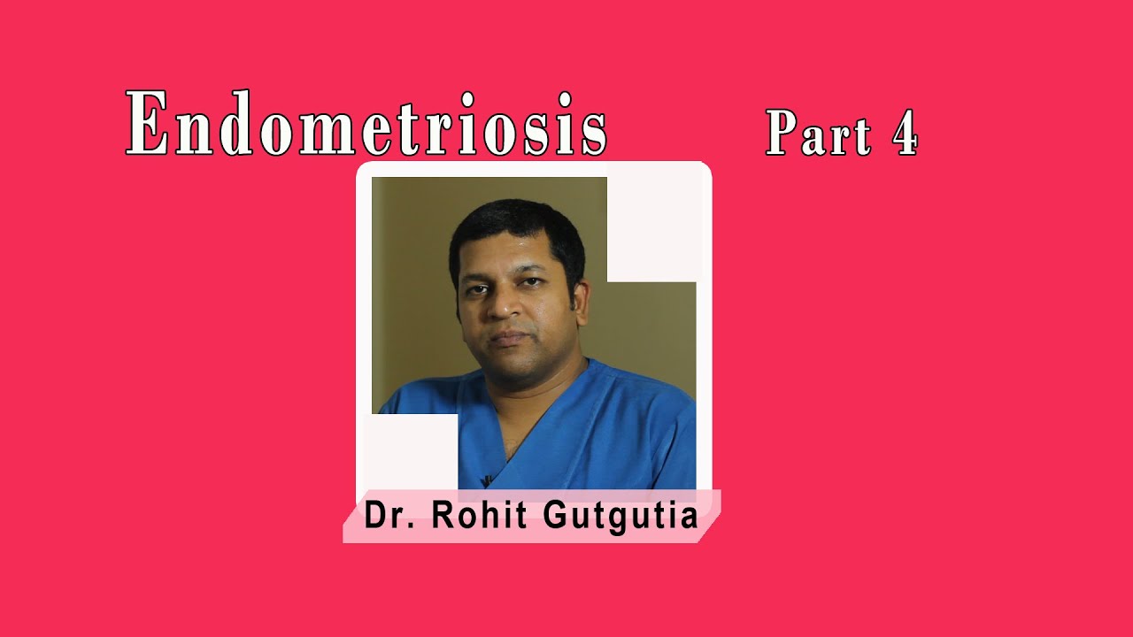 Endometriosis 4 : AMH Level,  Laparoscopy, Ovarian stimulation for IUI, IVF