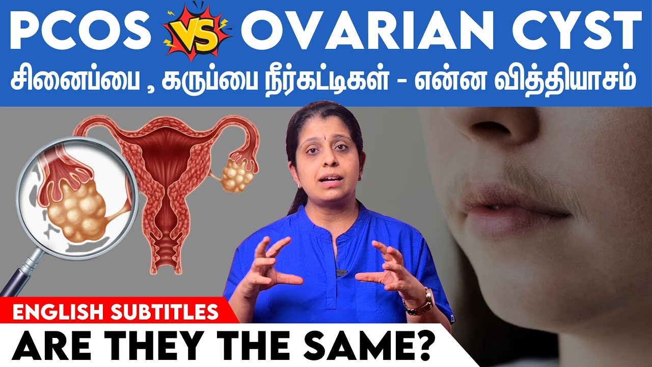 PCOS vs Ovarian cyst - Are they the same? கருப்பை மற்றும் சினைப்பை நீர்கட்டிக்கும் என்ன வித்தியாசம்?