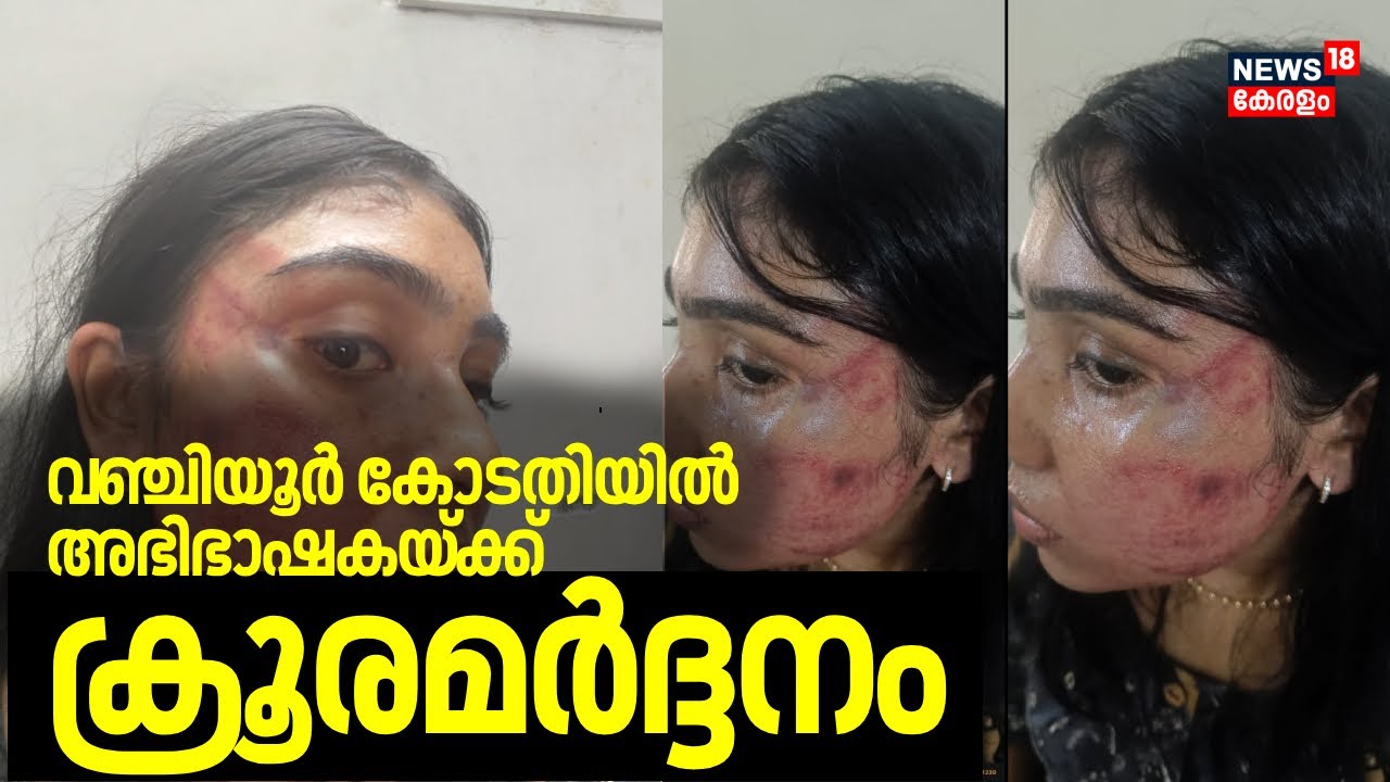 വ‍ഞ്ചിയൂർ കോടതിയിൽ അഭിഭാഷകയ്ക്ക്  സീനിയർ അഭിഭാഷകന്റെ ക്രൂരമർദ്ദനം | Vanchiyoor court |Advocate abuse