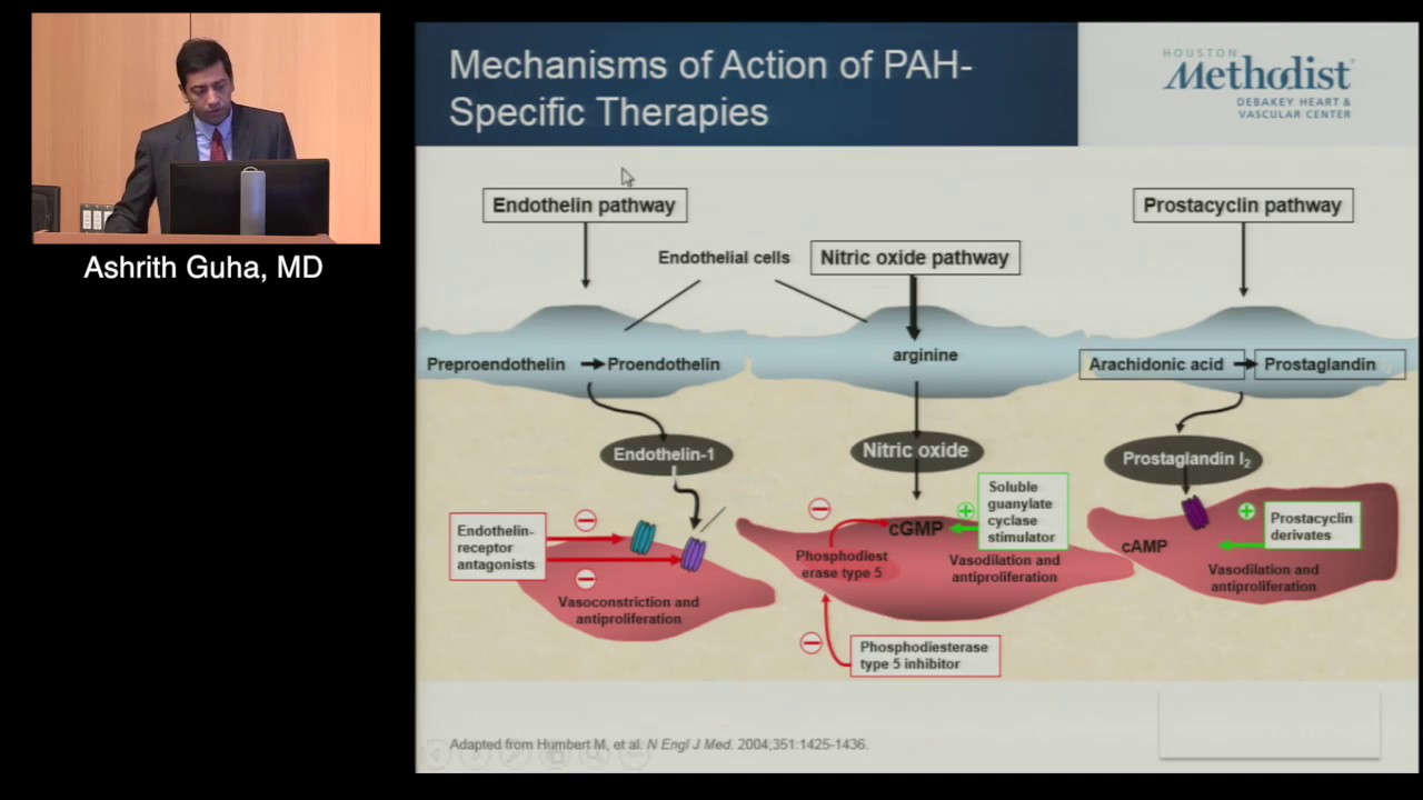 Update in Pulmonary Hypertension: An Emerging Paradigm Shift (Ashrith Guha, MD)