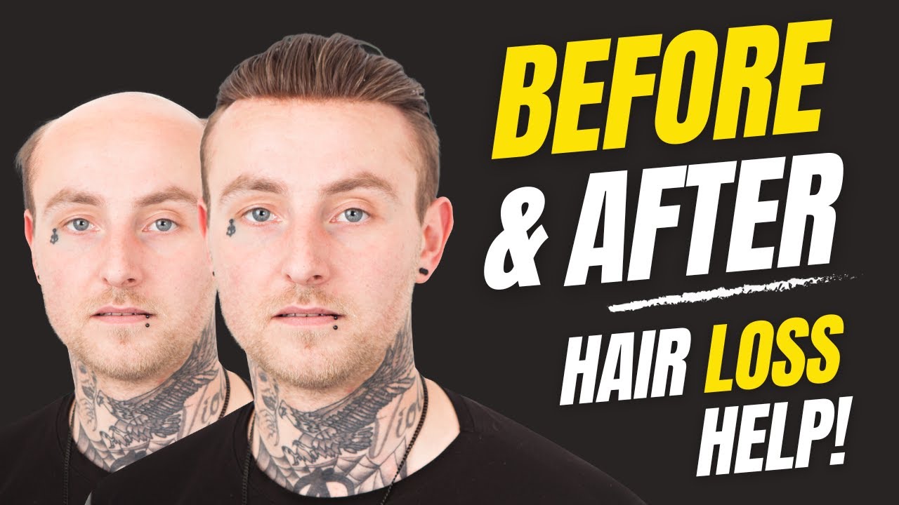 How to Apply (Attach) a Non-Surgical Hair Replacement System for Men with The Harris Brothers UK