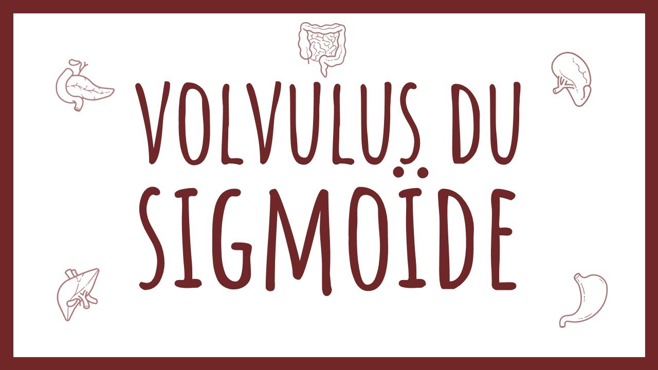 Sémiologie Chirurgicale - Volvulus du Sigmoïde