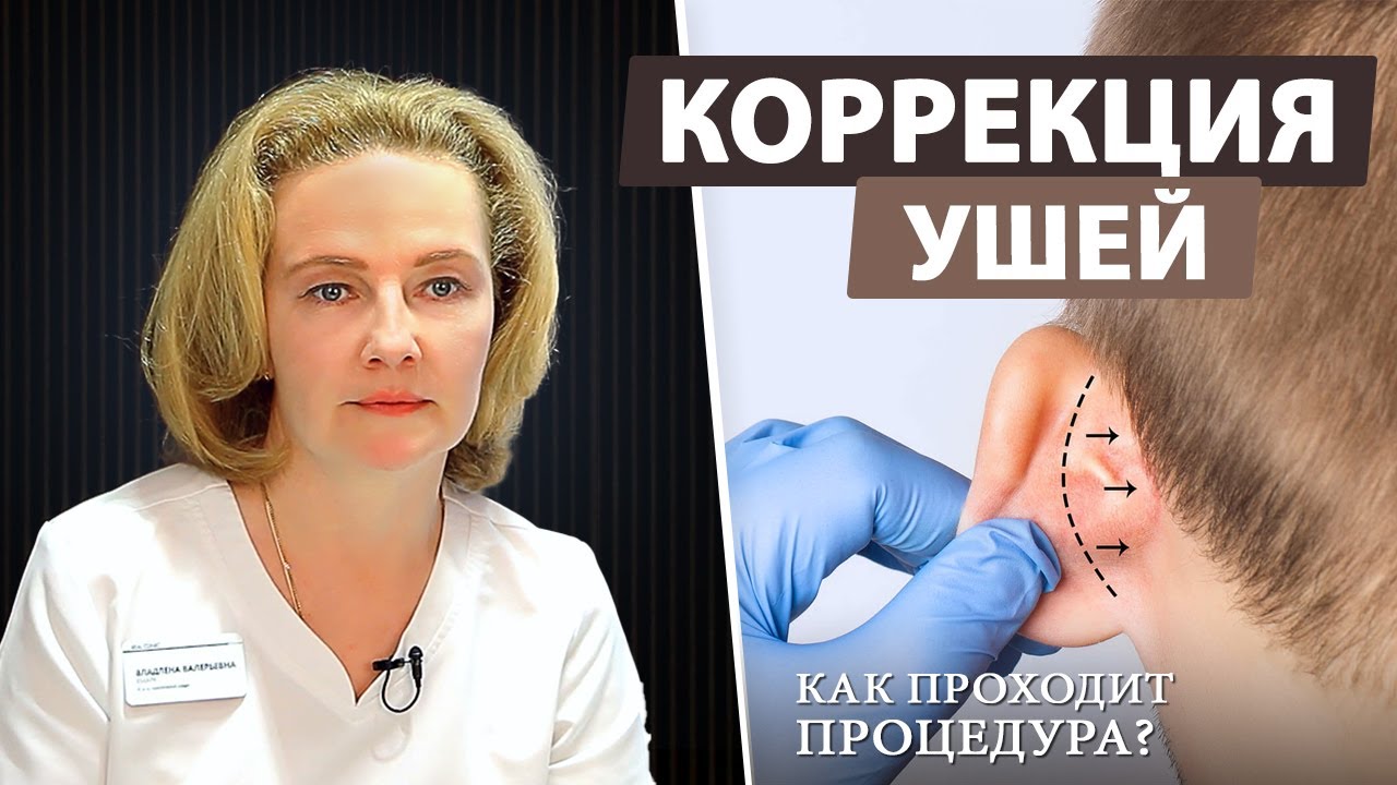 Отопластика — исправляем форму ушей и лопоухость