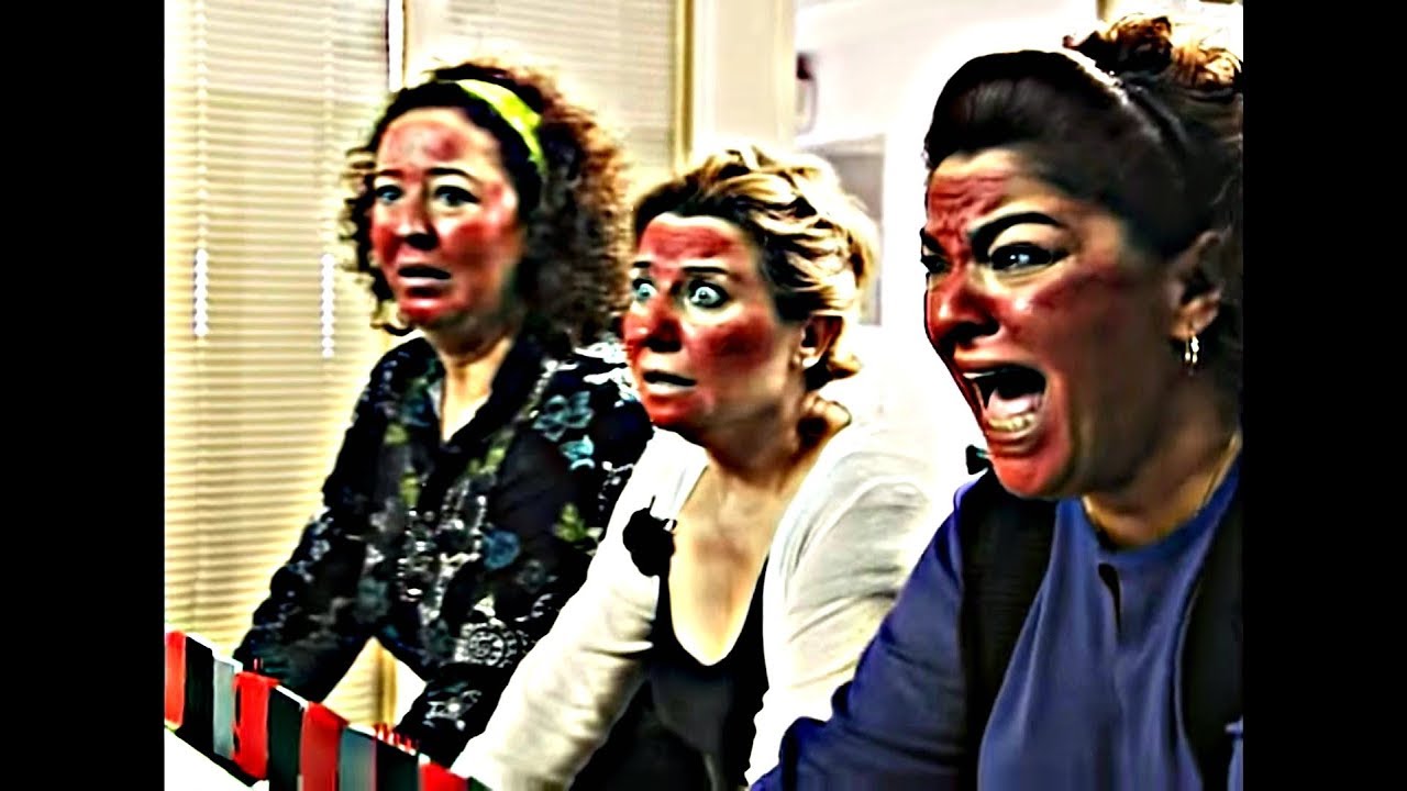 Akasya Hanımları Peeling Yaptırırsa