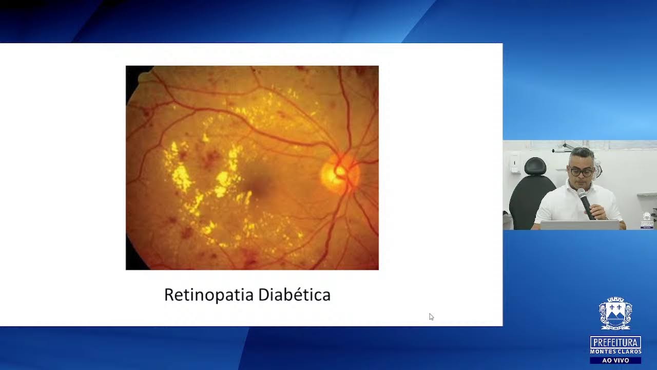 Palestra: Oftalmoscopia Direta - Dr. Breno Barreto Ribeiro