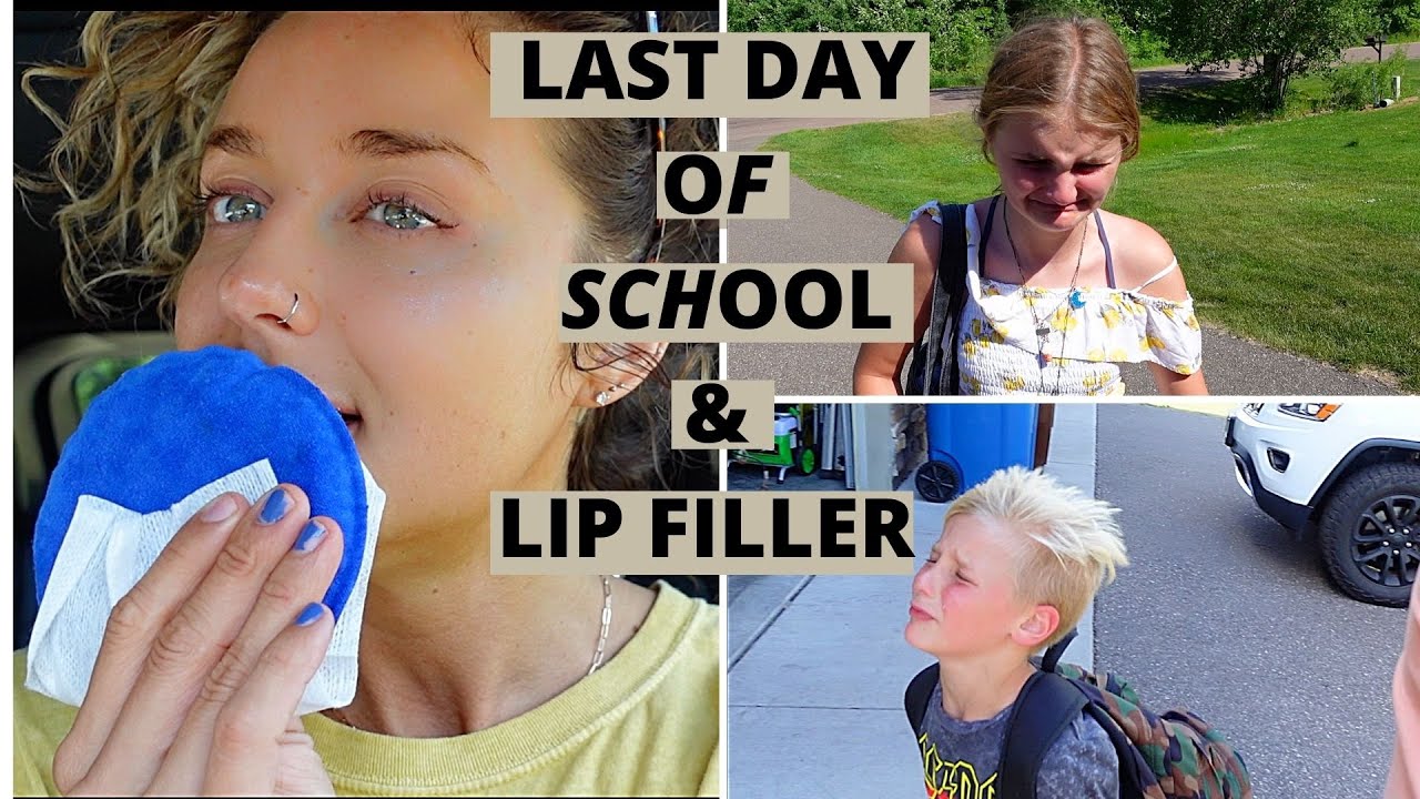 BREAKDOWNS & LIP FILLERS | VLOG 2021