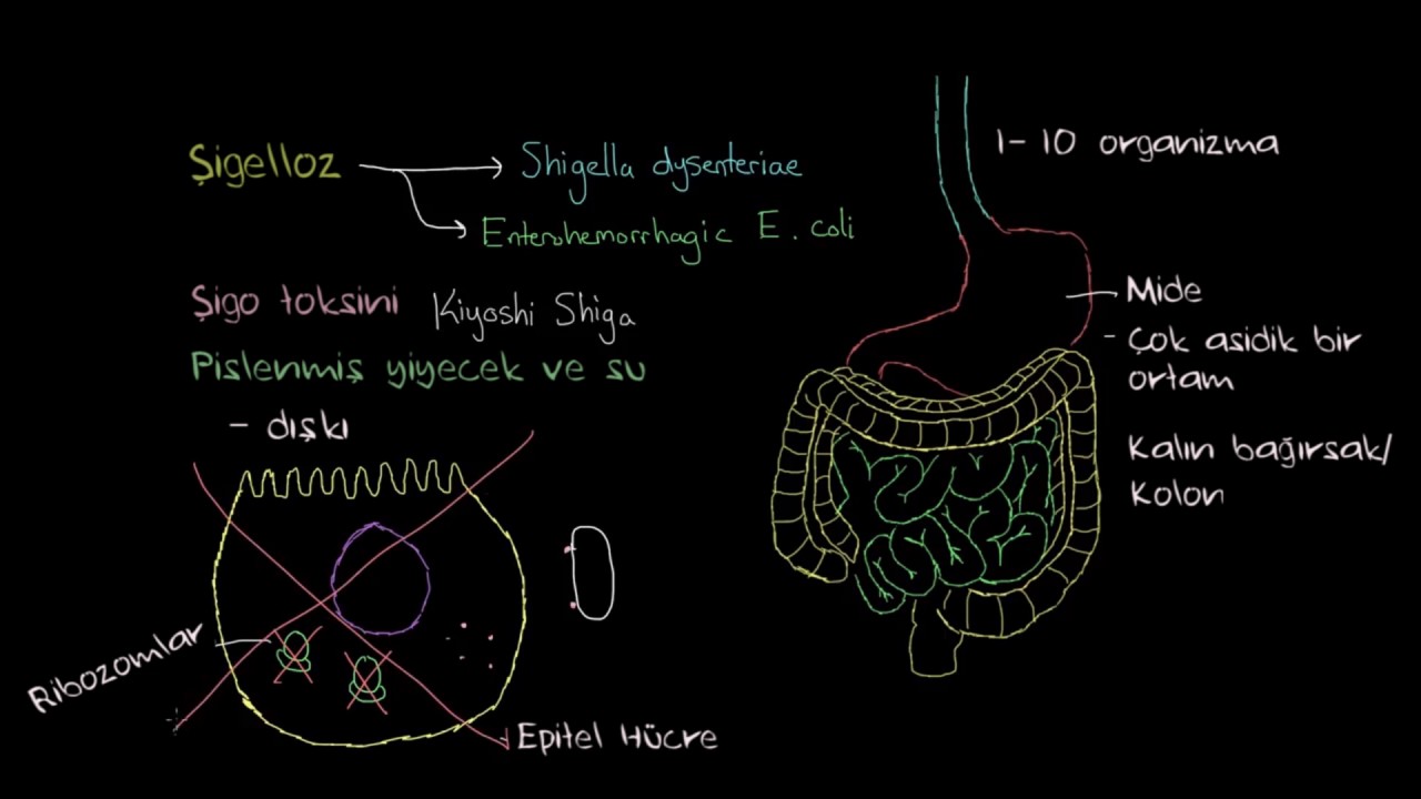 Şigelloz Nedir? (Sağlık ve Tıp)