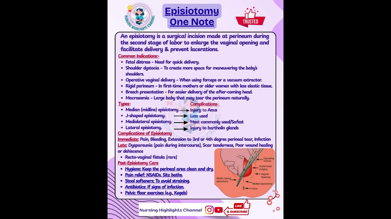 👩&zwj;🍼 Episiotomy One Note #norcet #aiims #kgmu #sgpgi #pregnancy #episiotomy #labour #baby #pain