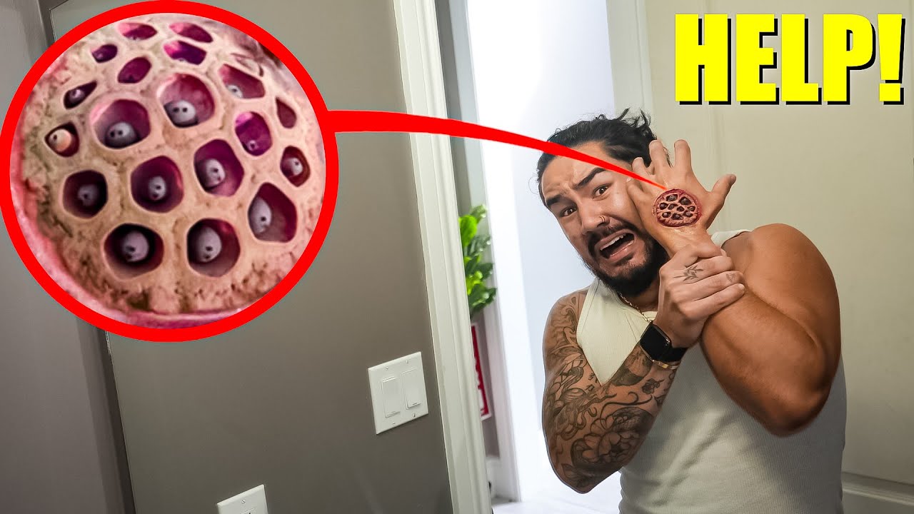 IF YOU EVER SEE HOLES FORMING ON YOUR HAND, RUN! (THERE WERE THINGS MOVING IN THE HOLES..)